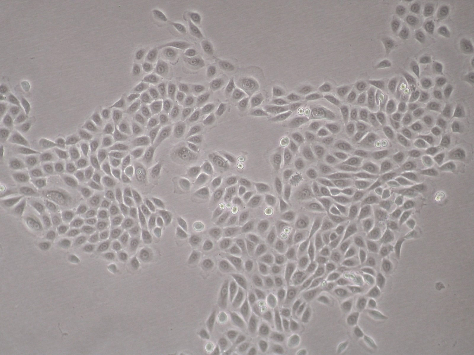 Normal Human Epidermal Keratinocytes