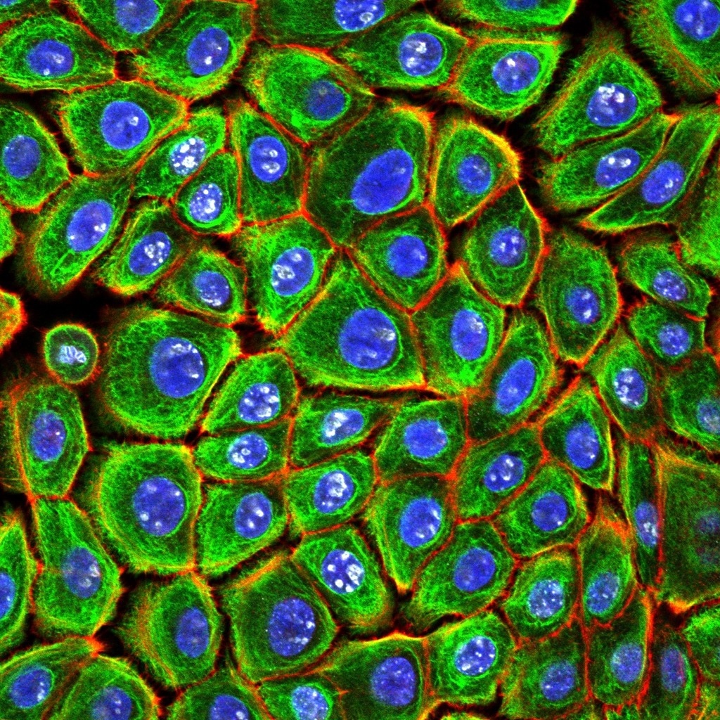 Normal Human Epidermal Keratinocytes