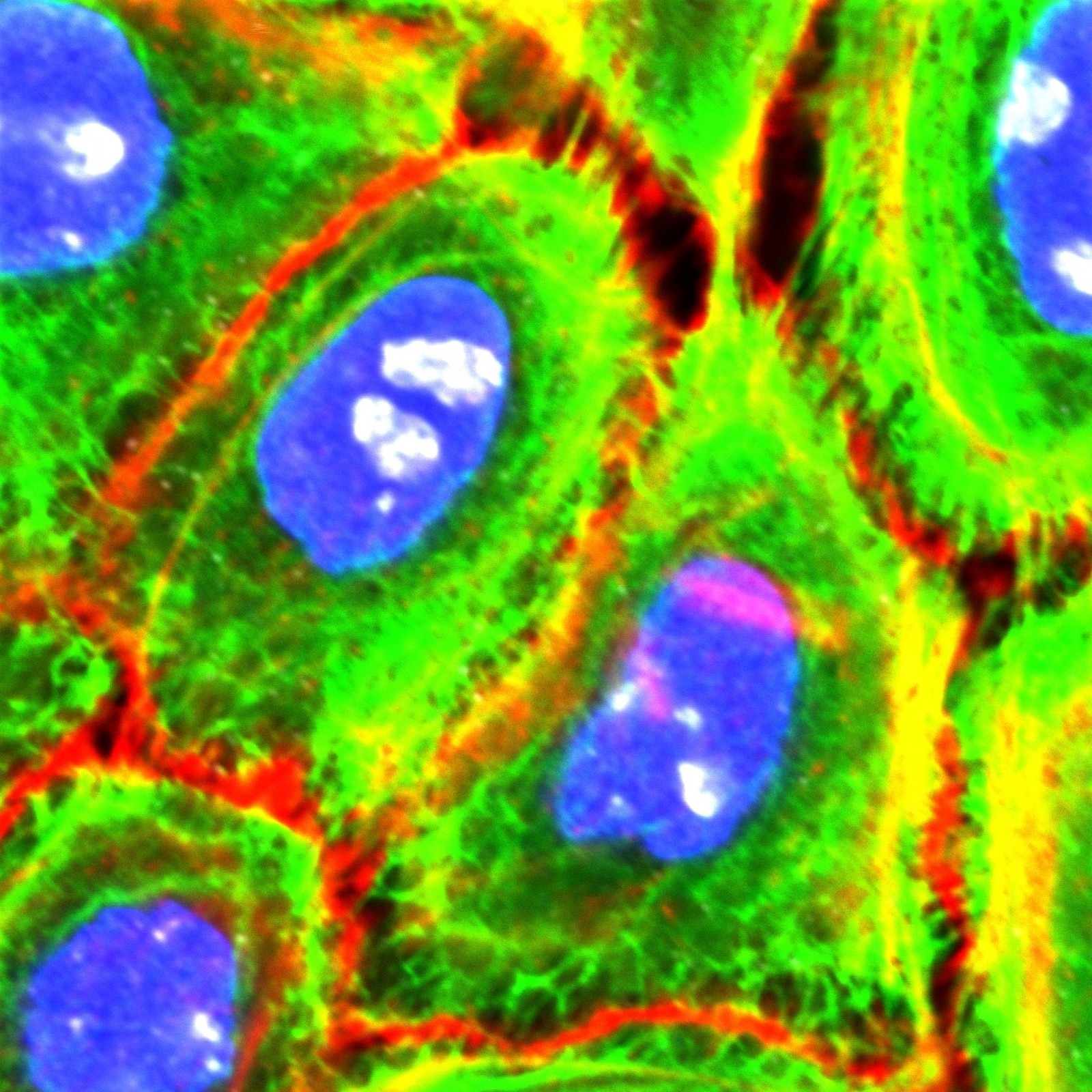 Normal Human Epidermal Keratinocytes