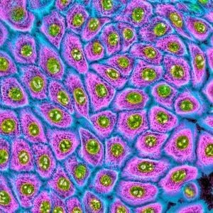 Normal Human Epidermal Keratinocytes