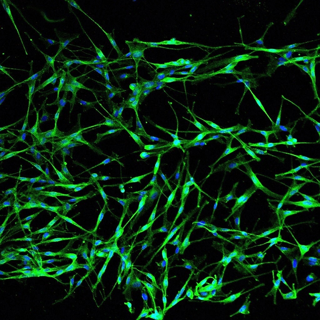 Normal Human Melanocytes