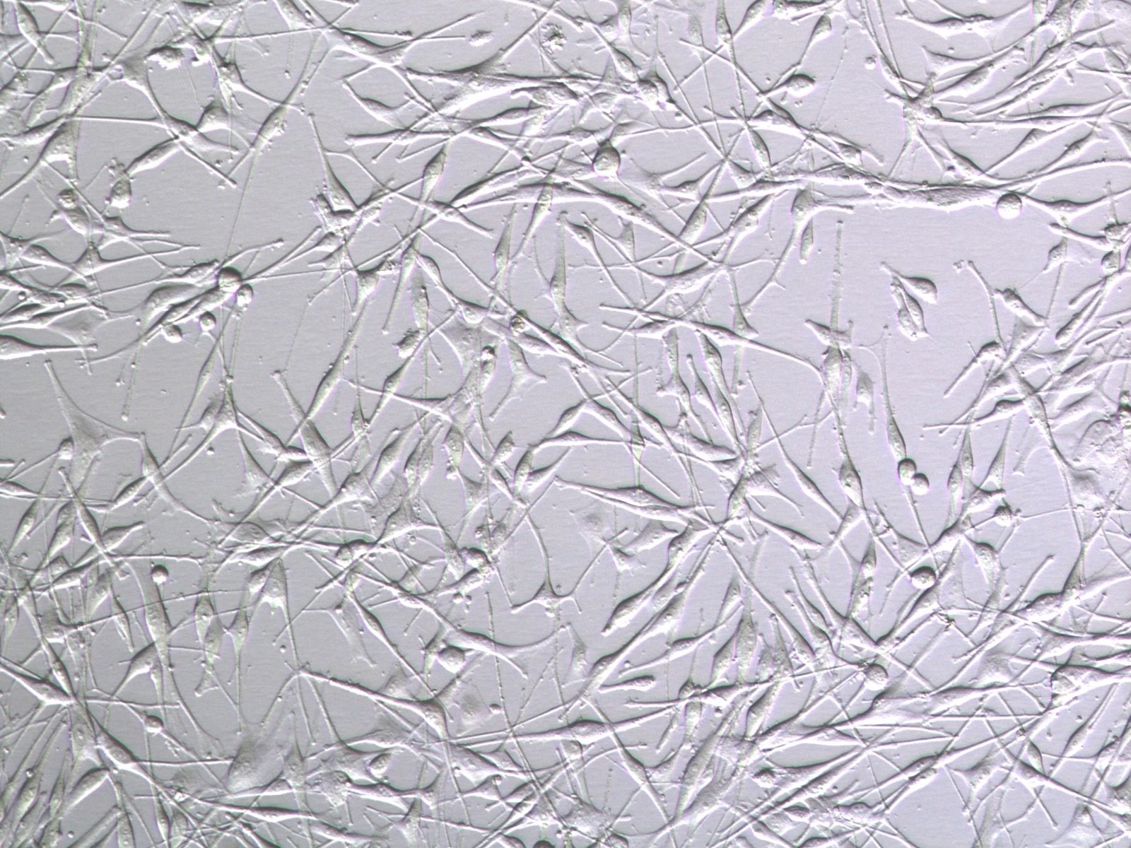 Normal Human Melanocytes