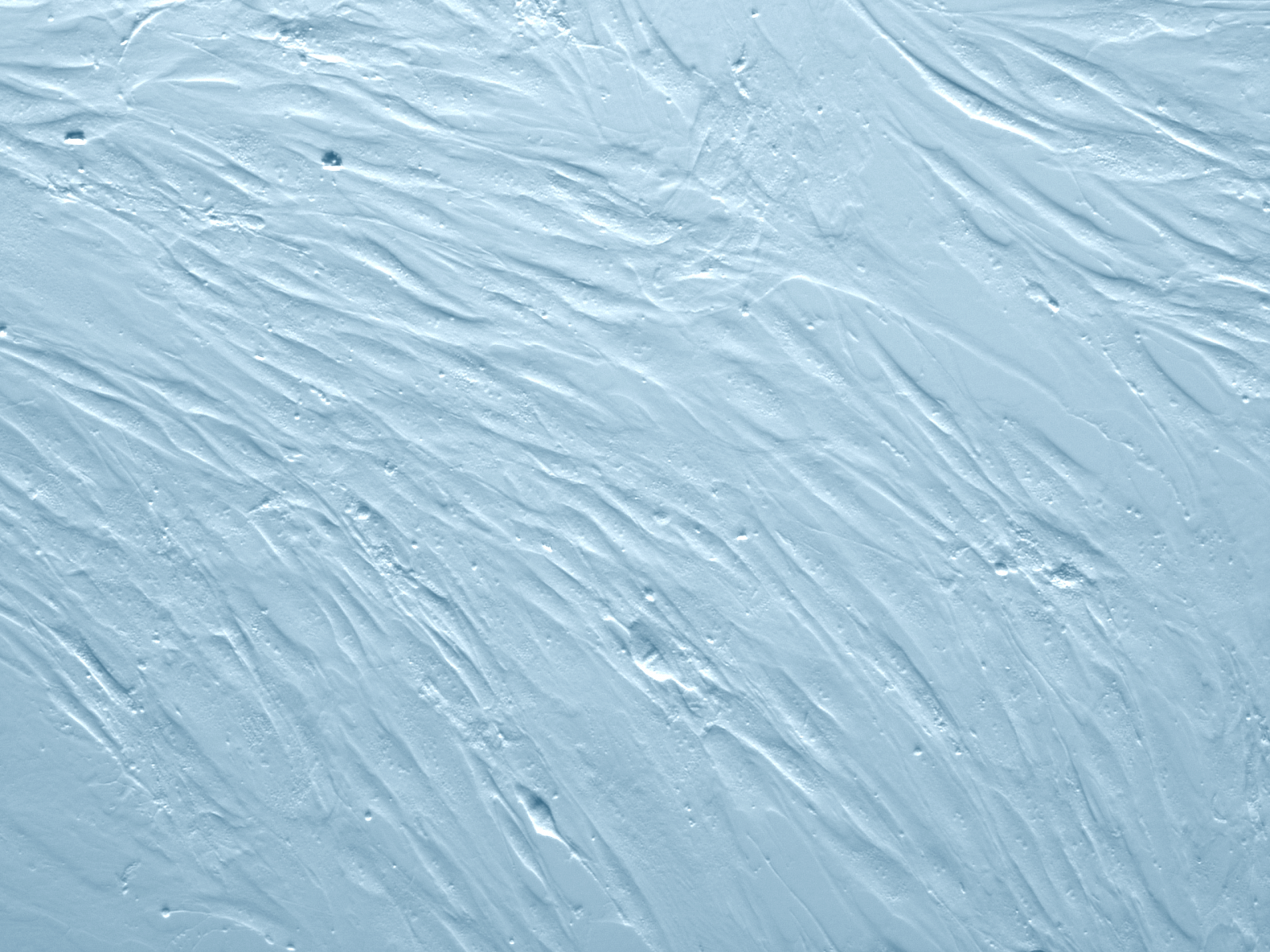 Normal Human Dermal Fibroblasts