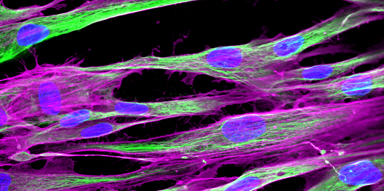 Normal Human Dermal Fibroblasts