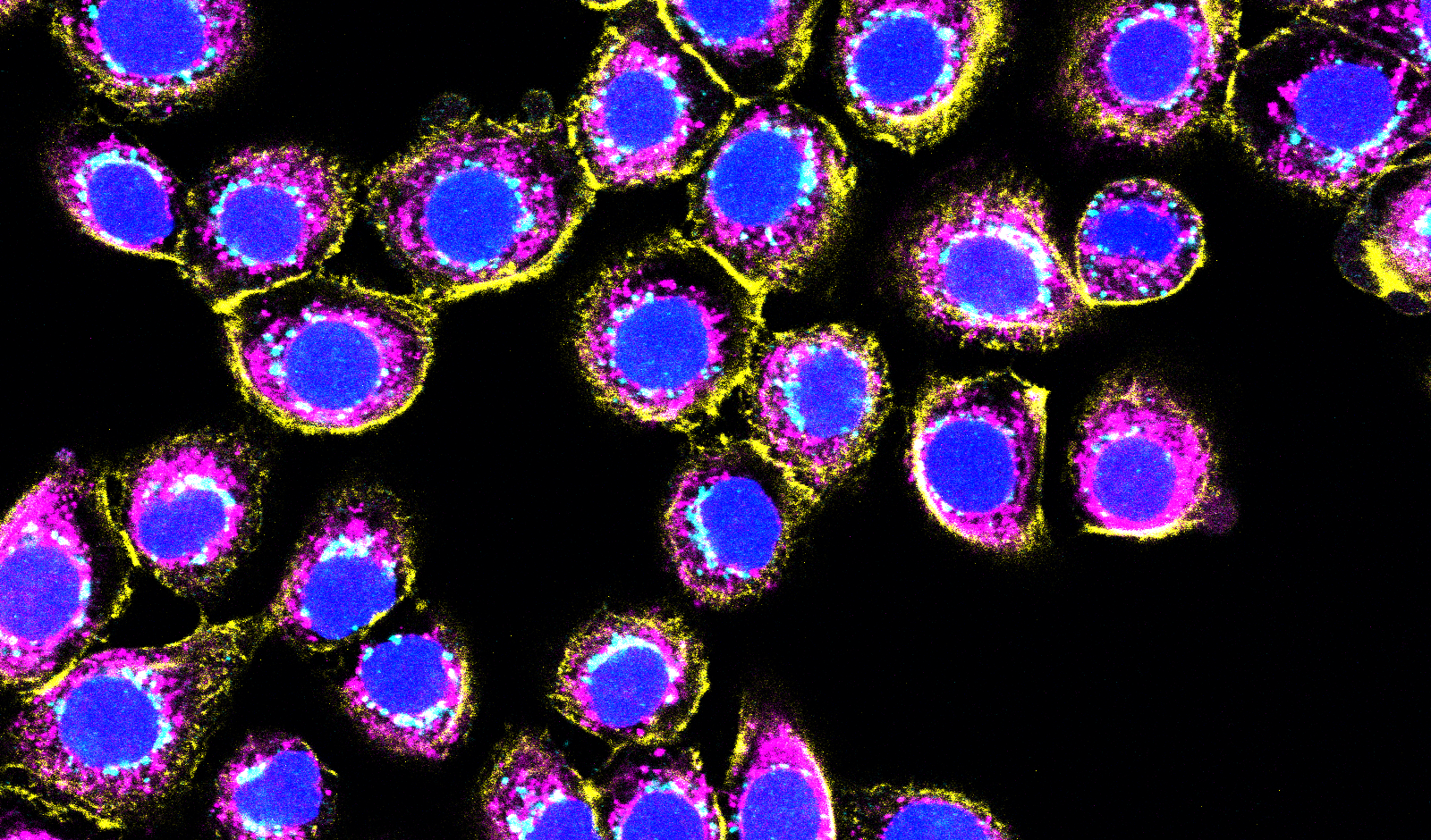 Normal Human Bronchial Epithelial Cells
