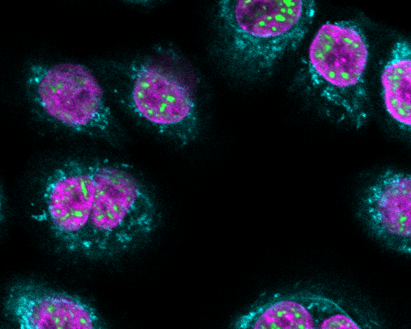 Normal Human Bronchial Epithelial Cells