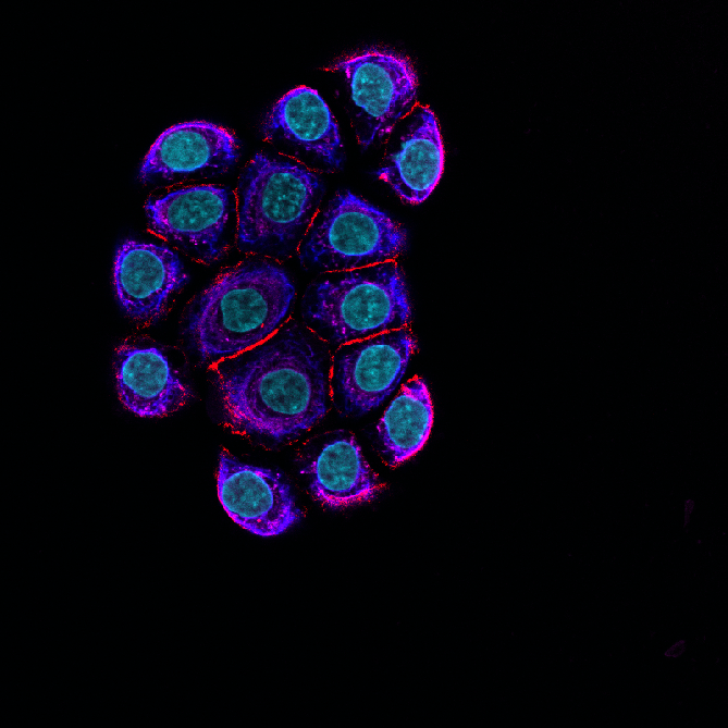 Normal Human Bronchial Epithelial Cells