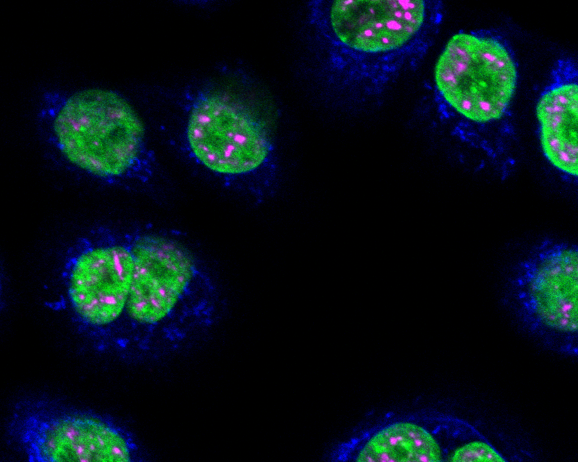 Normal Human Bronchial Epithelial Cells