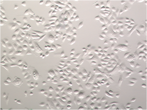 Normal Human Bronchial Epithelial Cells
