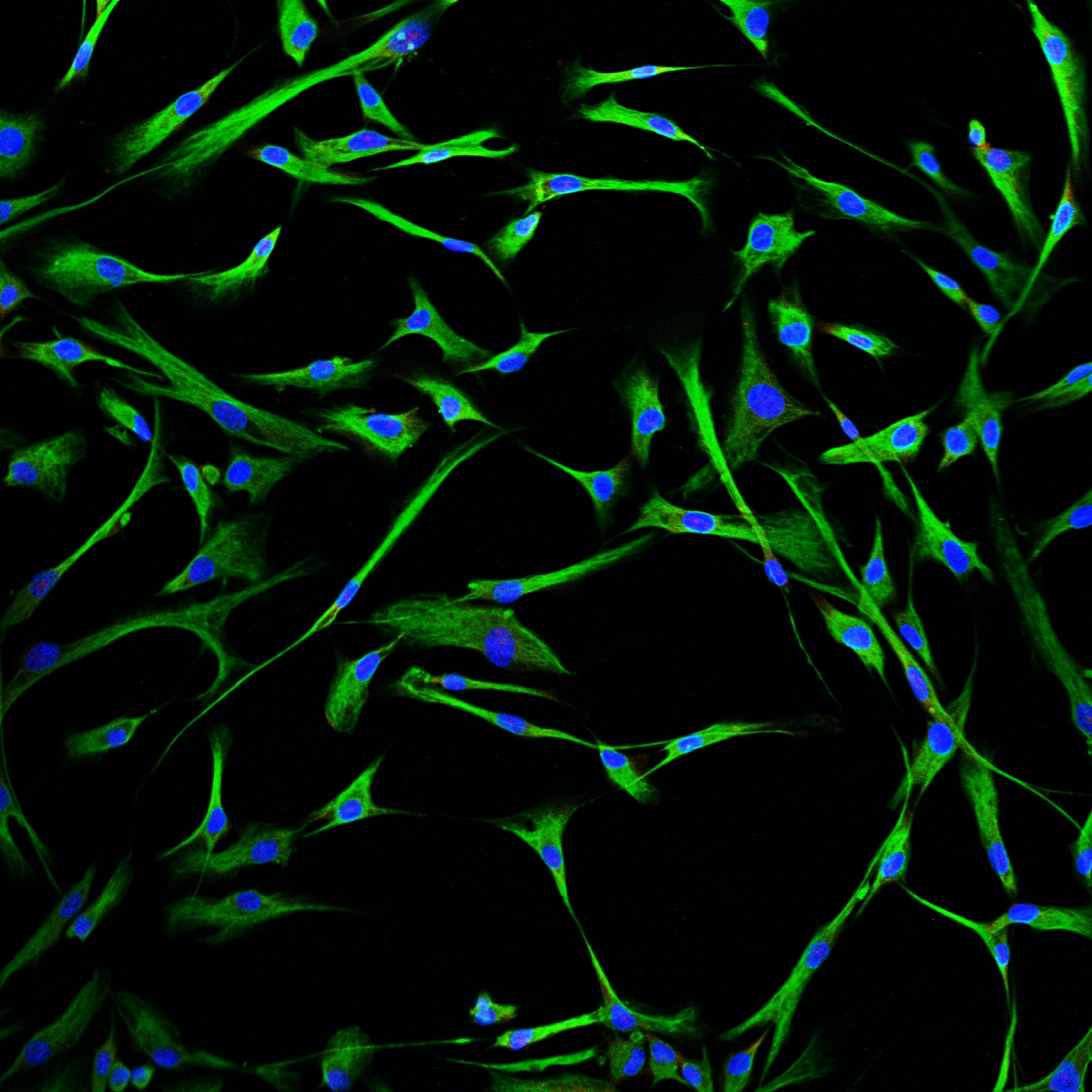Normal Human Bronchial Fibroblasts