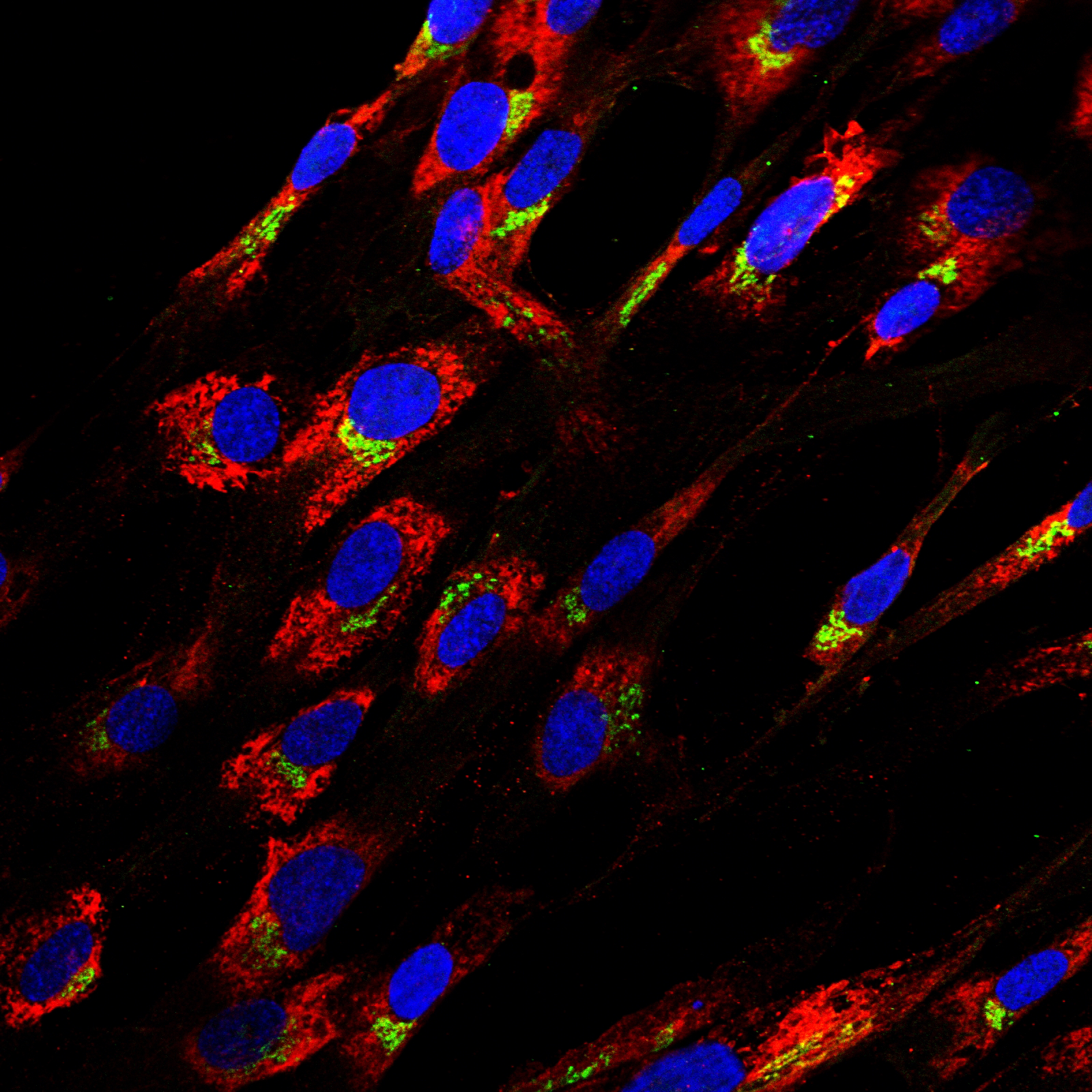 Normal Human Bronchial Fibroblasts