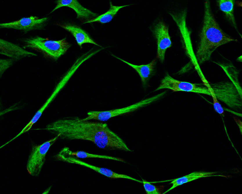 Normal Human Bronchial Fibroblasts