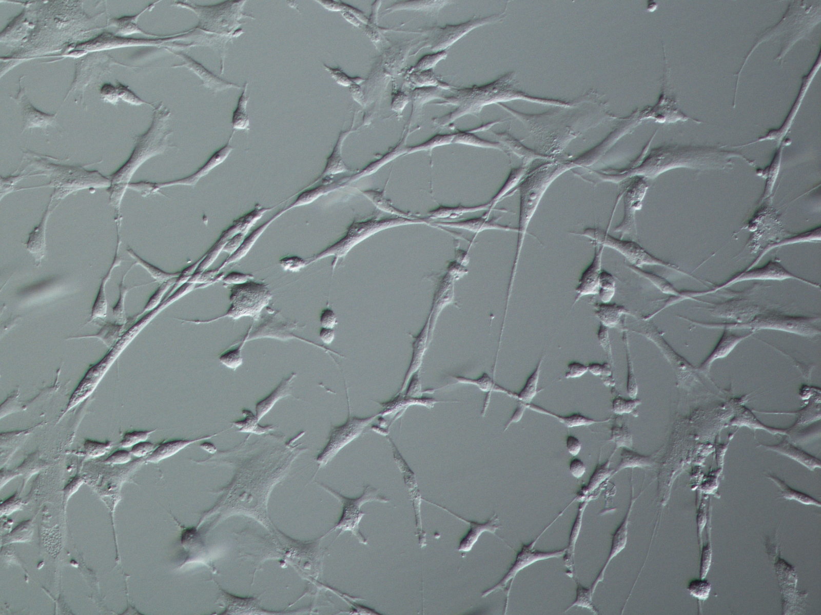 Normal Human Bronchial Fibroblasts