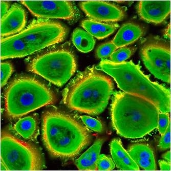 Normal Human Corneal Epithelial Cells