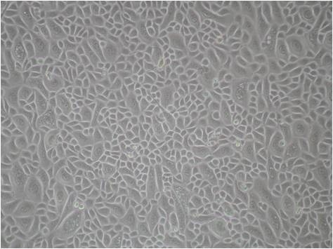 Normal Human Corneal Epithelial Cells