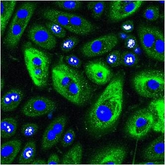 Normal Human Corneal Epithelial Cells