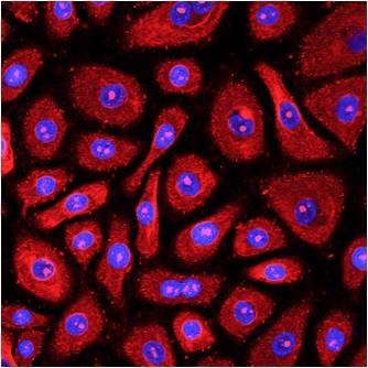 Normal Human Corneal Epithelial Cells