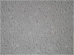 Normal Human Corneal Epithelial Cells