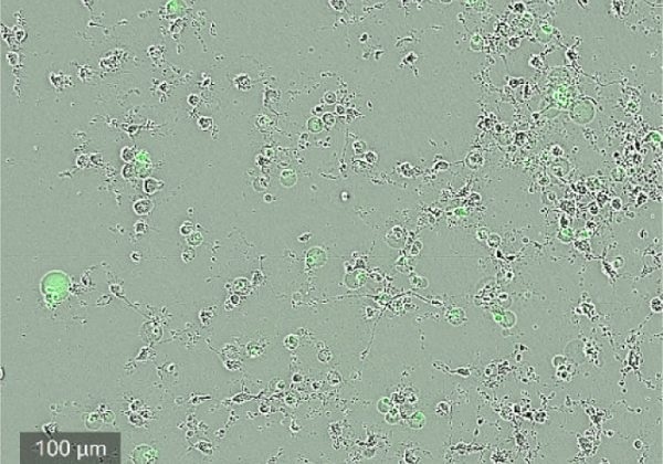 CELLCYTE X™