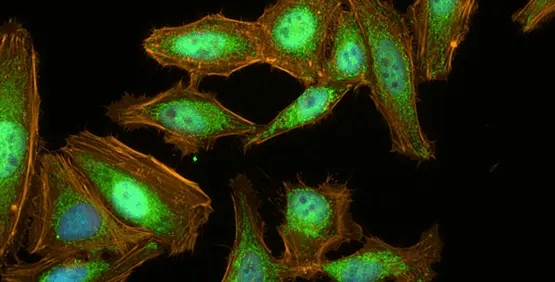 Digital Confocal