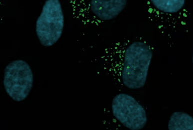 PLF Fluotars are powerful universal objectives with outstanding chromatic correlation for at least three wavelengths which makes them suitable for fluorescence imaging. Field planarity (PL) is computed for a 25 mm field of view. They are made of special glass to enable maximum transmission. This makes them powerful photon collectors in fluorescence microscopy