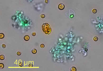 PLF Fluotars are powerful universal objectives with outstanding chromatic correlation for at least three wavelengths which makes them suitable for fluorescence imaging. Field planarity (PL) is computed for a 25 mm field of view. They are made of special glass to enable maximum transmission. This makes them powerful photon collectors in fluorescence microscopy