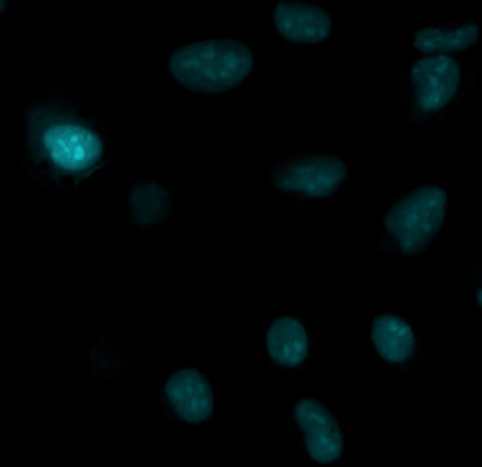 CFP - 40X U2OS cells transduced with bacmam nucleus
