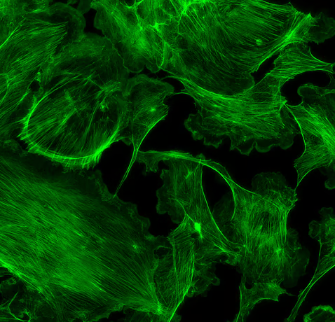 FITC - 40X BPAE cells stained with AlexaFluor 488 phalloidin (actin stain)