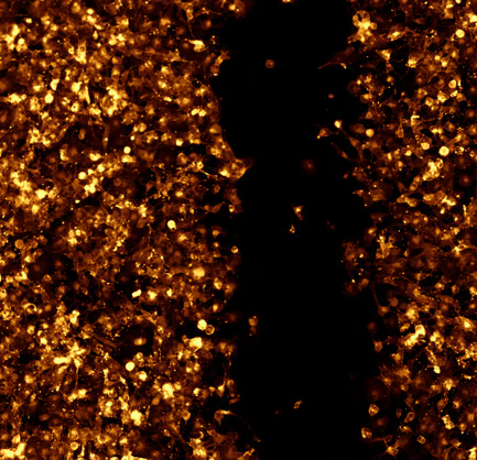Achieving Rapid Analysis with the ImageXpress Pico Automated Cell Imaging System