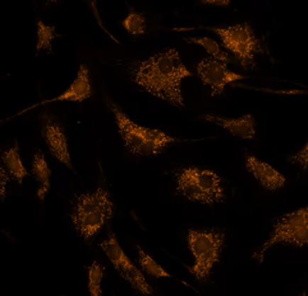 Texas Red - MitoTracker Red stained BPAE cells (mitochondria)