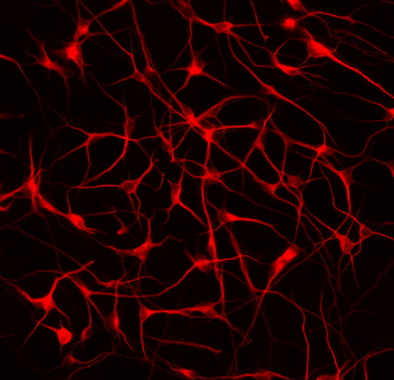 Cy5 - 40X iPSC derived neurons stained for MAP2B zoomed in