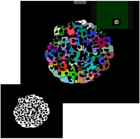 IN Carta Image Analysis Software for robust, quantitative results