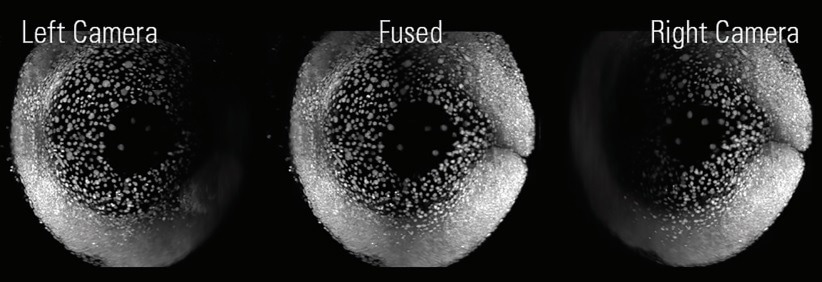 Luxendo MuVi SPIM—Light-Sheet Microscopy