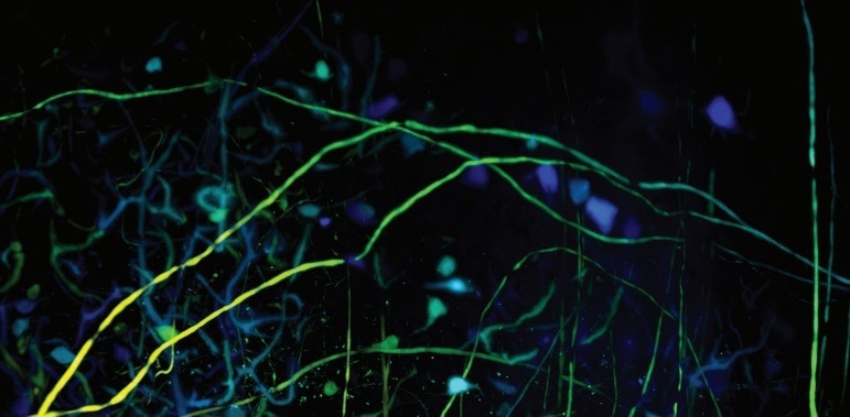 Luxendo MuVi SPIM—Light-Sheet Microscopy
