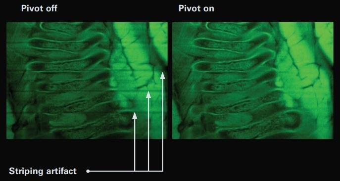 Luxendo MuVi SPIM—Light-Sheet Microscopy