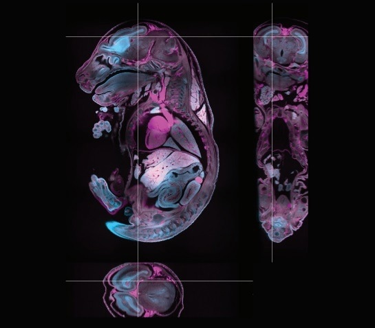 Luxendo MuVi SPIM—Light-Sheet Microscopy