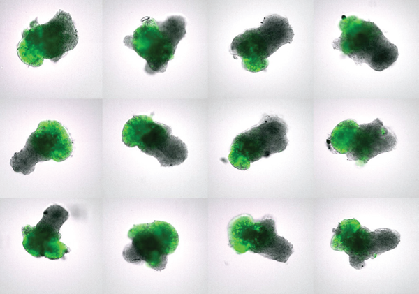 Organoid imaging: Fish-derived organoids differentiating into retinal tissue (green).