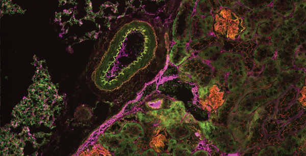 Tissue section of mouse kidney.