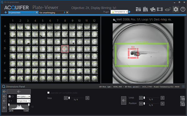 Three-day-old embryo of the epi:GFP;myl7mR transgenic line. Zebrafish embryos visualized in Plate-Viewer software after automated region of interest selection.