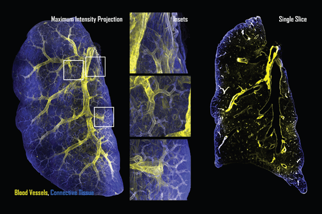 Light-sheet images of a lung.