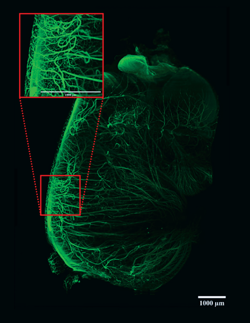 LCS image of developing nerves in a whole mouse embryo. Sample cleared with DBE. Tiled 3x4 image acquisition
