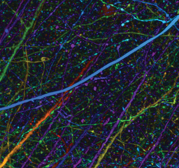 Maximum intensity projection with depth color coding of dendrites and spines in a brain slice.