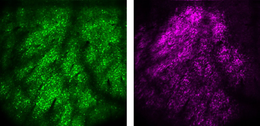 Co-expression of GCaMP6s (green) and soma-restricted C1V1-mRuby2 (magenta) in layer 5A neurons of mouse visual cortex at a depth of ~400 μm below the pia (right). Both acquired with Nikon 16x 0.8 NA objective at 920 nm.