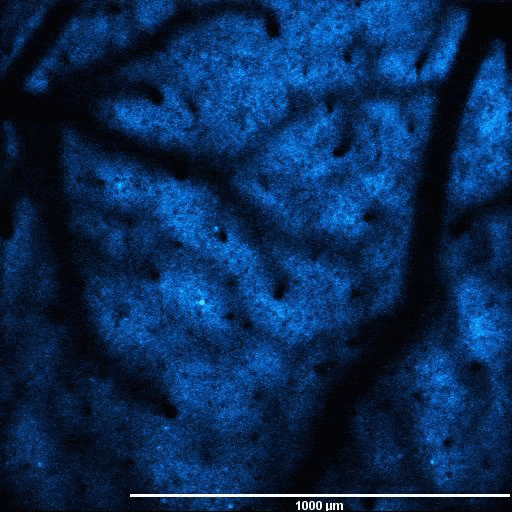 Spontaneous fluorescence fluctuations in neurons expressing GCaMP6 in a transgenic mouse.