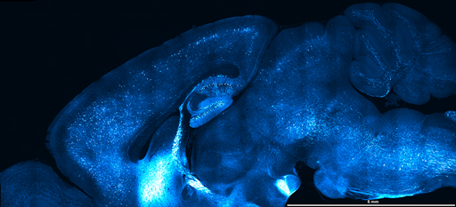 Large FOV montage (44 on scope with FN28 vs 108 tiles on scope with FN18) of hippocampal slice and details of selected tile. In-house data.