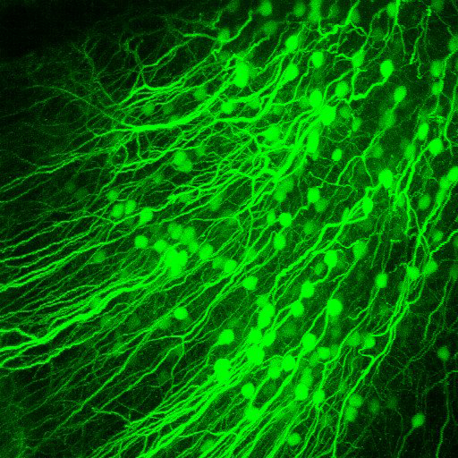 3D view of volumetric stack recorded using the ETL focusing module. Layer 5B neurons in a mouse visual cortex in vivo, labeled with tdTomato.