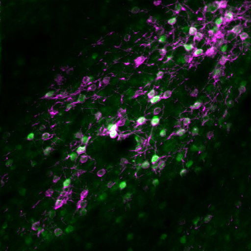 Co-expression of GCaMP6s and soma-restricted C1V1-mRuby2 in layer 5A neurons of mouse visual cortex. Acquired in vivo, ~400 μm below pia at wavelengths 920 nm and 765 nm.