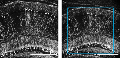 Comparison of FOV between 1x zoom (left) and 0.8x zoom (right) in galvo-galvo mode