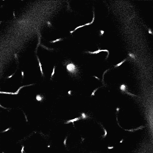 Constriction of a penetrating arteriole with the 594 nm LED. Five pulses of 100 ms duration, with 100 ms in between, were presented. Speed 4x real time.