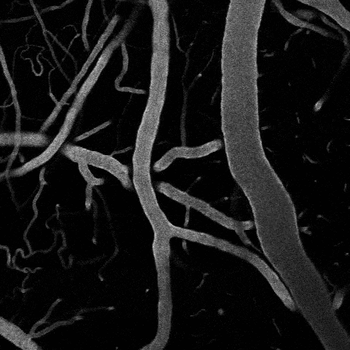 Full-field activation with the 594 nm LED in a PDGFRB/ReaChR mouse. Image is looking down at pial surface vessels in the neocortex labeled with FITC dextran. A single 100 ms pulse from the 549 nm LED was used to stimulate the vessels. The dark flash indicates the time of the optical stimulation. The image darkens because the detectors are briefly blocked by mechanical shutters to protect them from the intense stimulation light. Speed 4x real time.